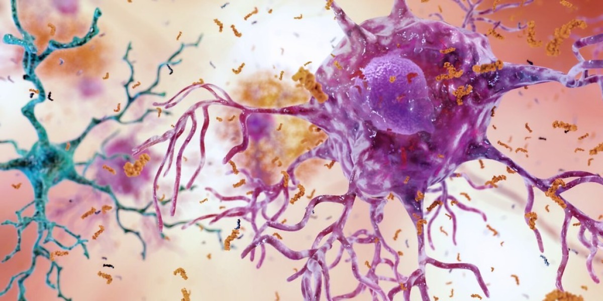 Chronic Inflammation Care Reinvented: How ILARIS Is Leading the Change