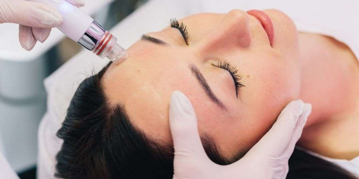 Smooth Out Those Fine Lines with Pico Laser: No Surgery Needed