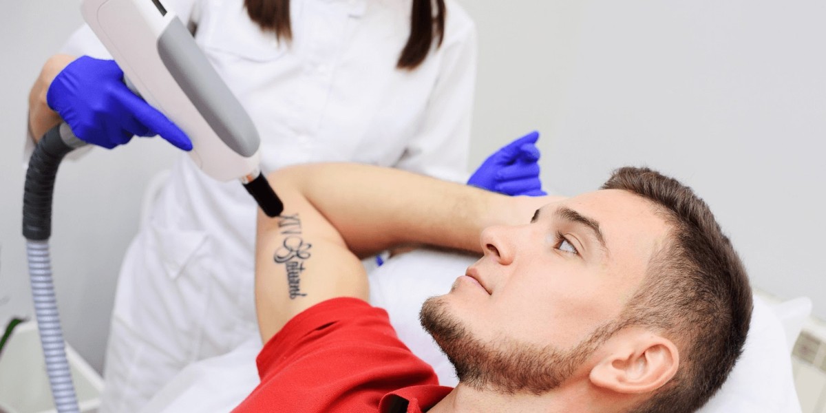 Laser Tattoo Removal Dubai – Safe & Skin-Friendly Transformation