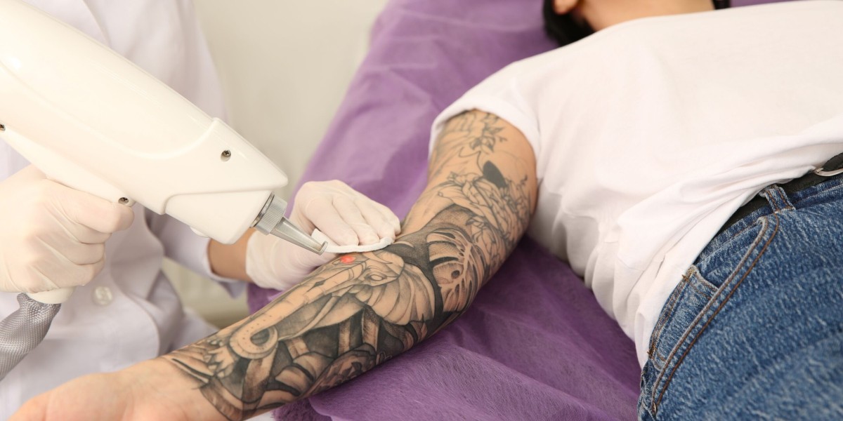 Unwanted Ink? Laser Tattoo Removal in Dubai Has You Covered!