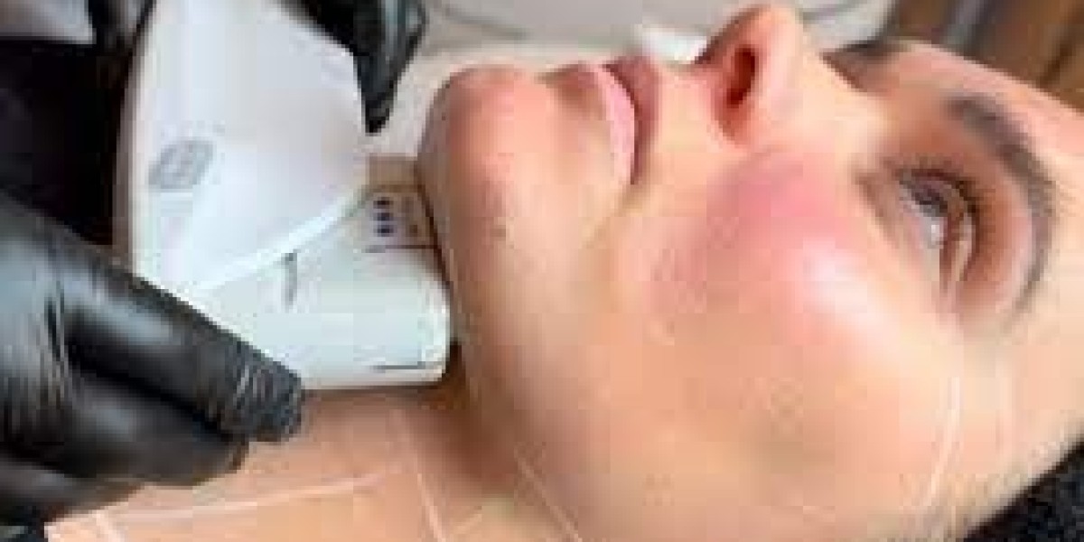HIFU Treatment: The Non-Invasive Answer to Sagging Skin and Wrinkles
