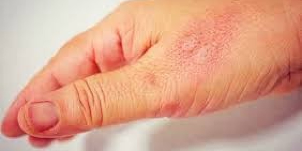Understanding Inflammation: The Key to Unlocking Your Health Potential