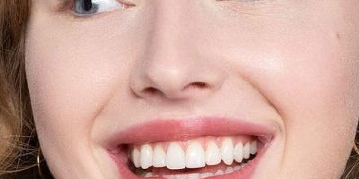 How Teeth Whitening Can Enhance Your Confidence