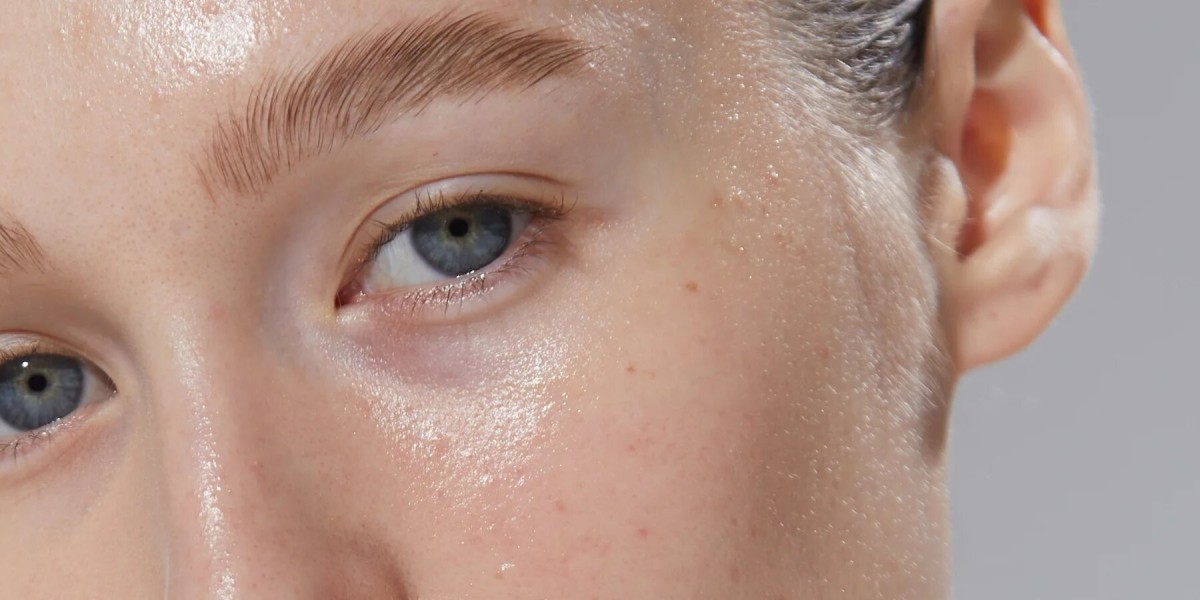 Exploring the Financial Aspects of Large Pores Treatments