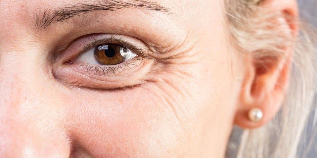 The Best Fillers for Fine Lines in Riyadh