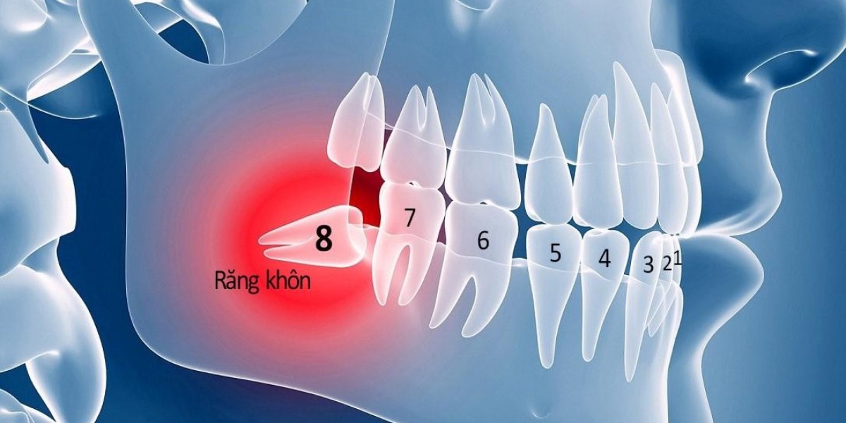 Nhổ răng nào nguy hiểm nhất? Những điều bạn cần biết trước khi quyết định