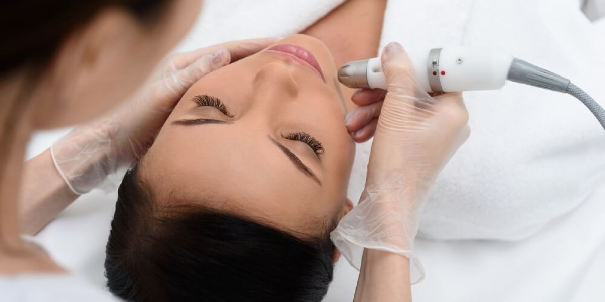 How Much Should You Expect to Pay for Fractional CO2 Laser Treatment?