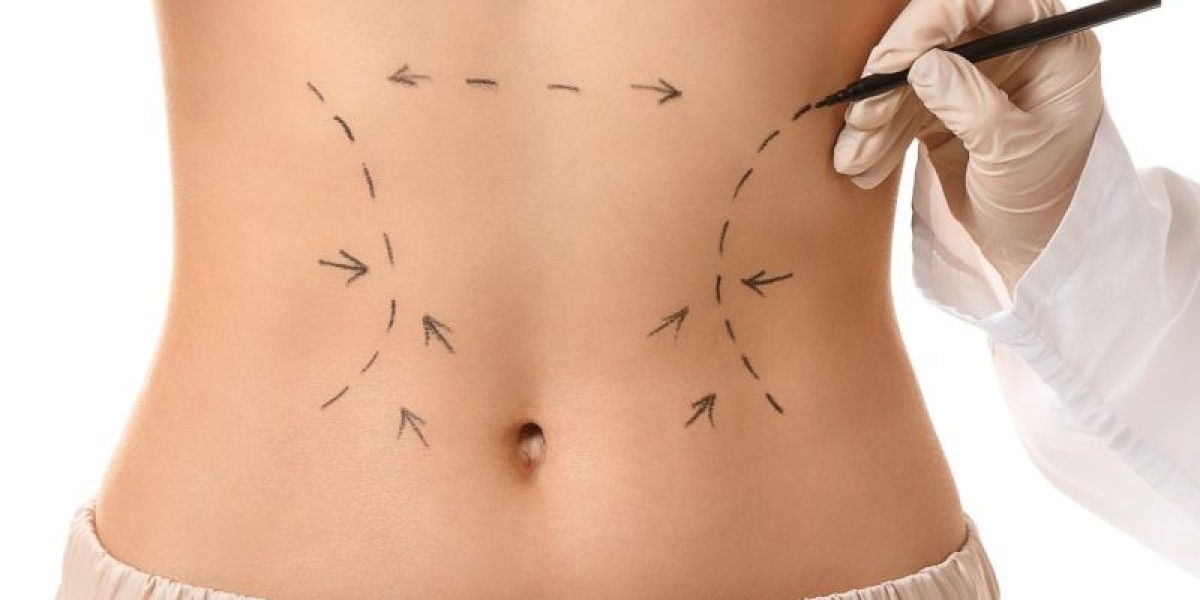 Exploring the Recovery Process After a Tummy Tuck Operation