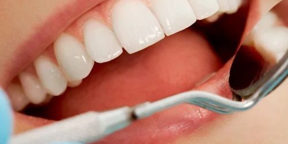 Invisalign: Is It Really Worth the Extra Cost Over Metal Braces?