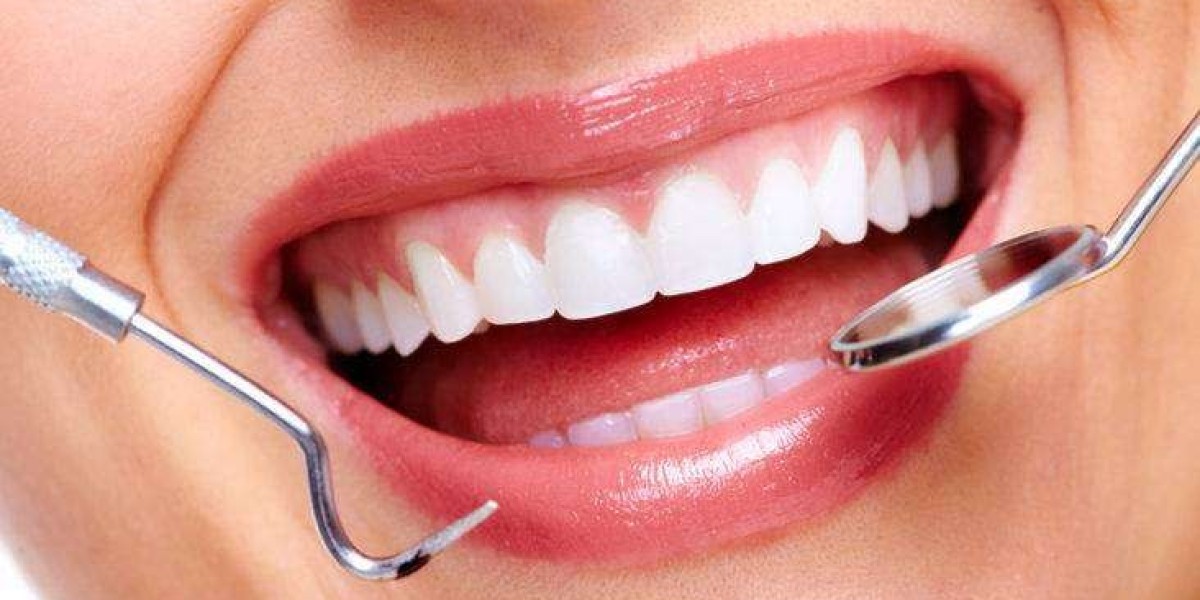 Dental Crowns in McKinney: A Complete Guide to Restoring Your Smile