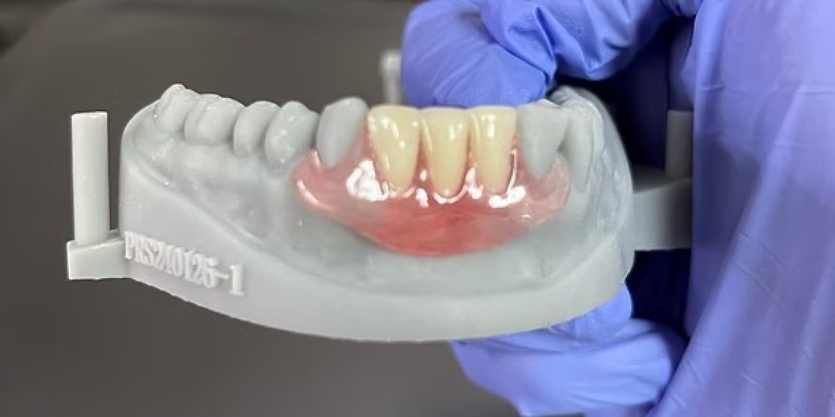 Dental Crown & Bridge: Enhancing Your Smile with Advanced Restorative Solutions