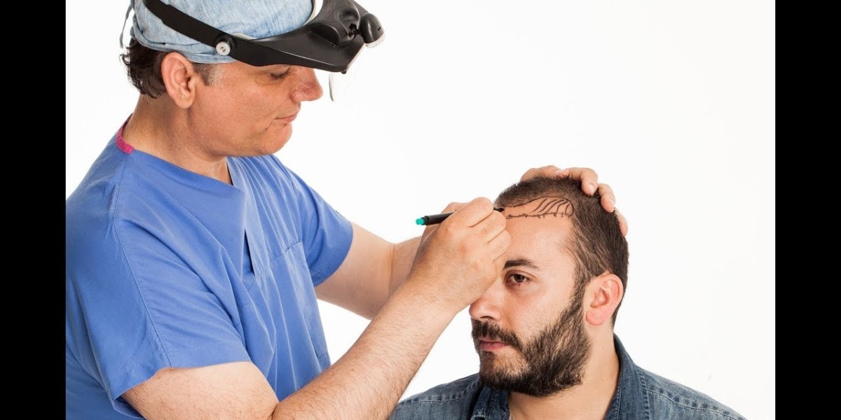 Non-Surgical Alternatives to Hair Transplant in Buraydah
