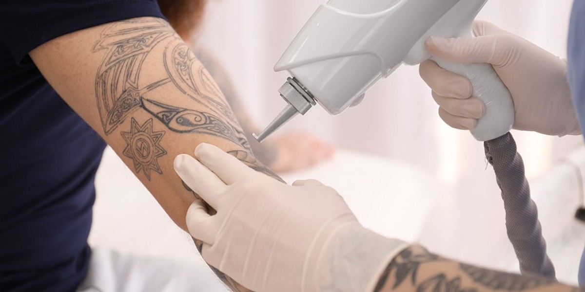 Dubai's Trusted Experts in Safe and Effective Tattoo Removal