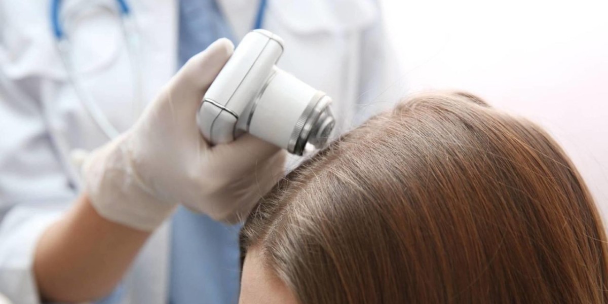 Can a Hair Transplant Help with Balding?