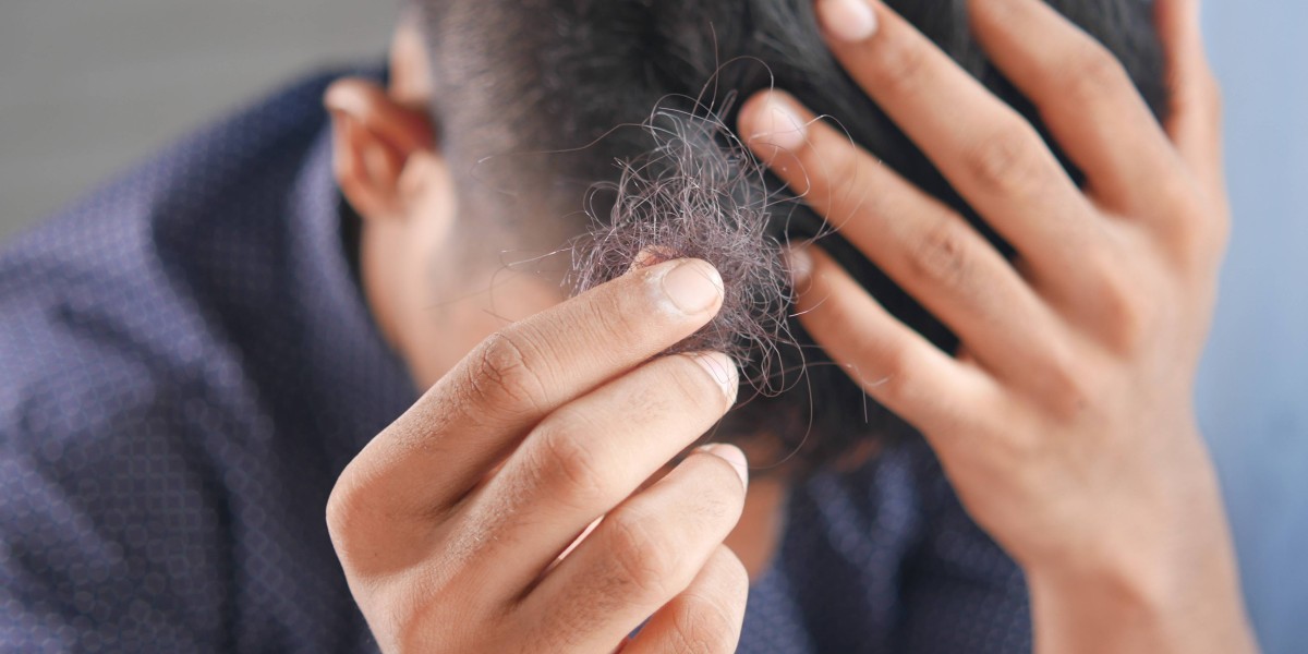 Who Should Test DHT Levels Before Using Finasteride?