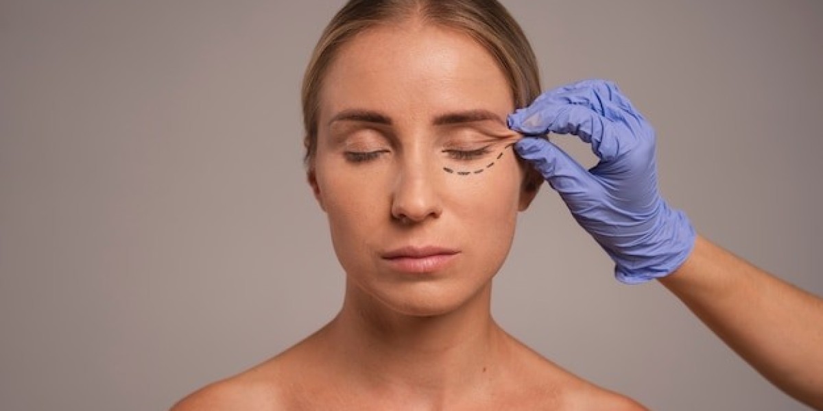 Does Thread Lift Treatment Work for Deep Wrinkles?