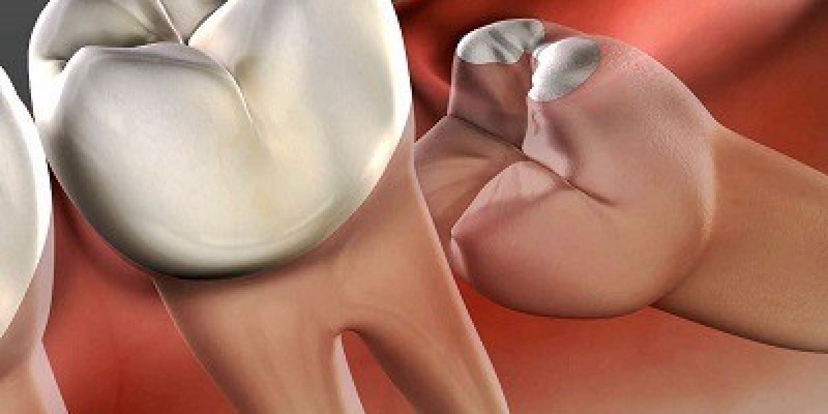 Tooth Extraction vs. Saving a Tooth: What’s the Right Choice?