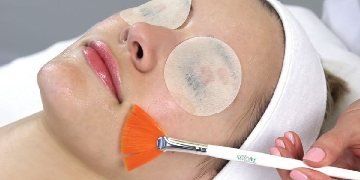 Chemical Peels in Riyadh: How They Treat Acne & Scars
