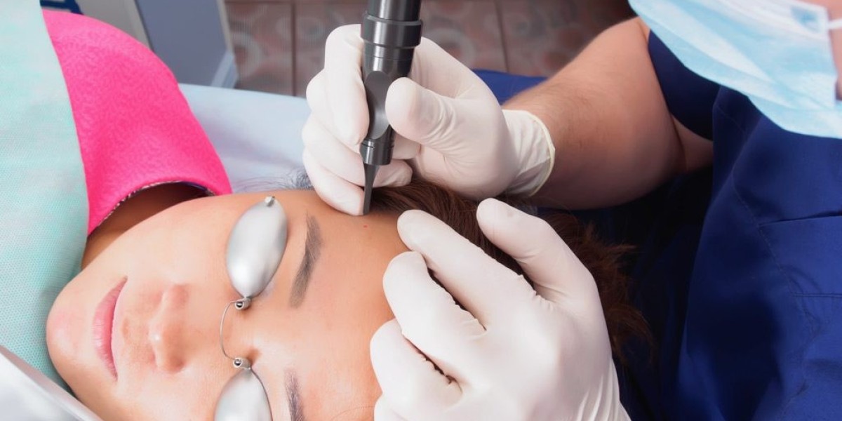 How Much Will Fractional CO2 Laser Treatment Cost You?