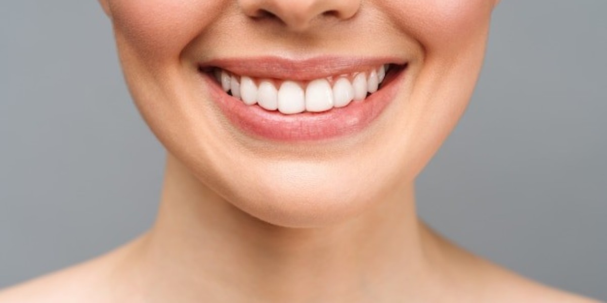 A Smile So White – Discover the Power of Our Teeth Whitening