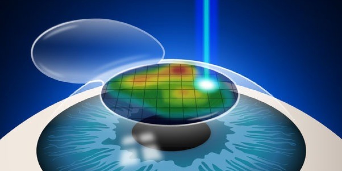 Contoura Vision LASIK Surgery: Affordable Eye Care Near You
