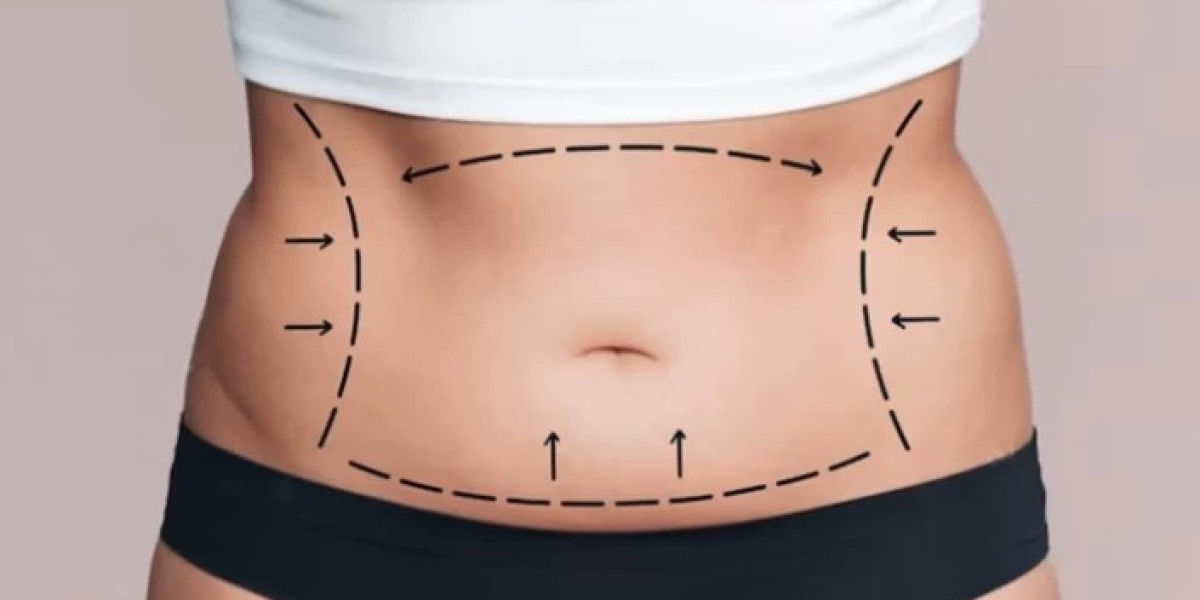 Can a Tummy Tuck Be Done Without Visible Scarring?