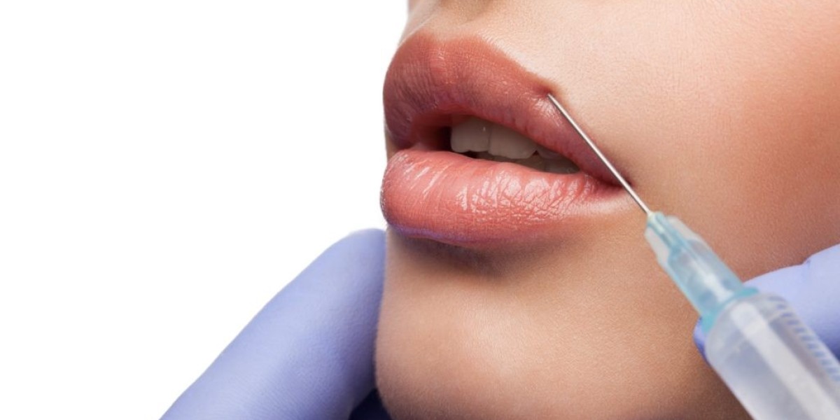 Enhance Your Smile with Lip Fillers in Riyadh