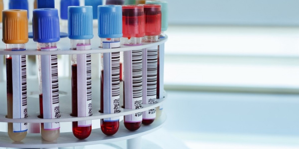 Ready-to-Use Laboratory Test Kits Market: Market Size, Share, and Forecast for the Next Decade