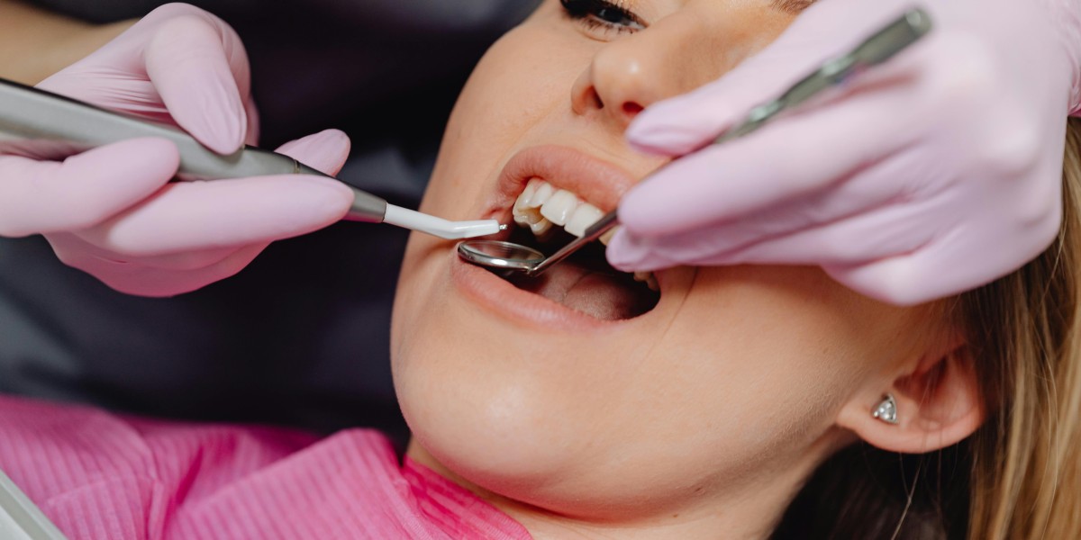 Dental Implants in Sydney: A Permanent Solution for Missing Teeth