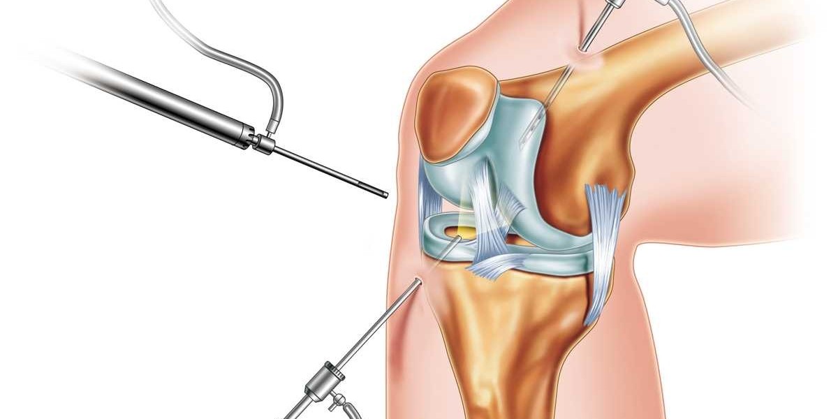 Arthroscopy Devices Market Driving Innovations And Enhancing Minimally Invasive Surgical Procedures
