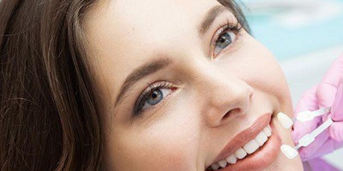 Best Teeth Whitening Techniques Used in Dubai