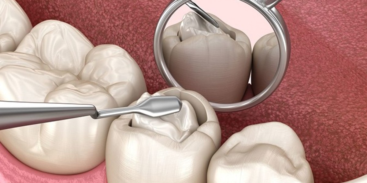 Understanding Tooth Filling Cost: A Complete Guide