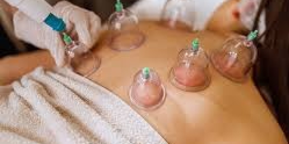 Best Cupping Set for Sports Injuries – Heal Faster & Stronger