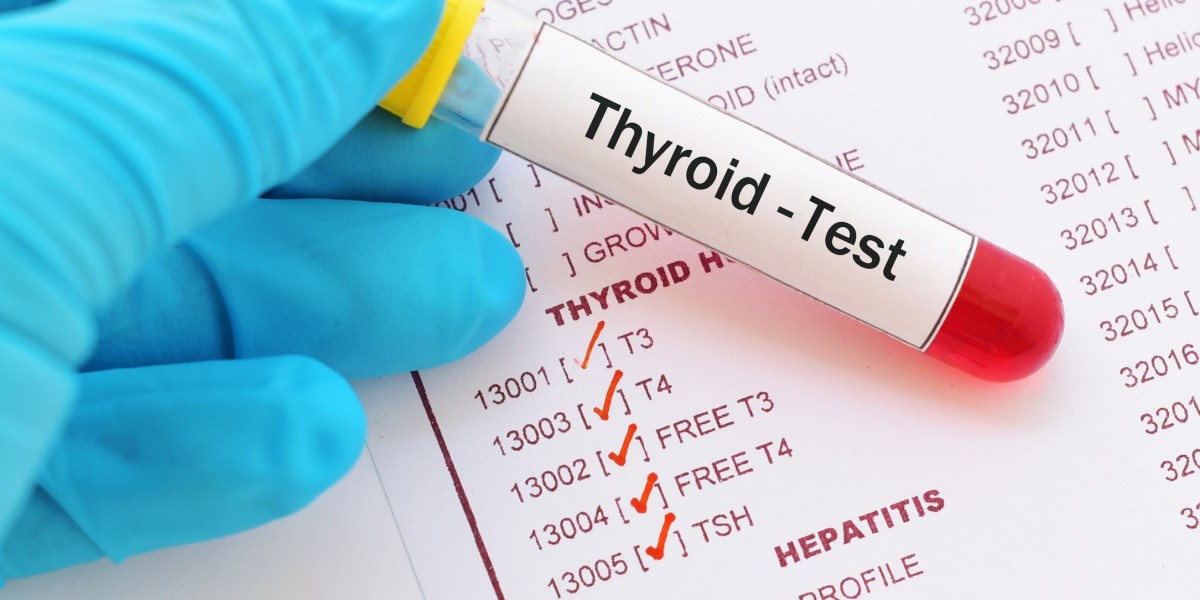 Thyroid Function Test Market Redefining Healthcare With Cutting-Edge Innovations And Digital Health Integration