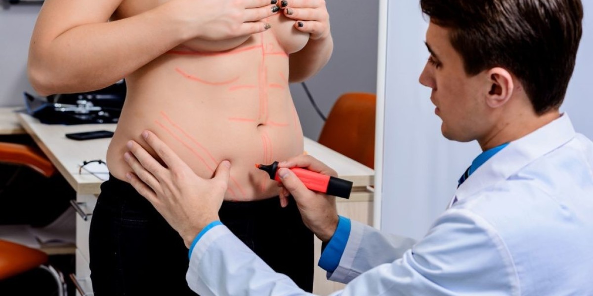 Breast Lift: Understanding the Terminology