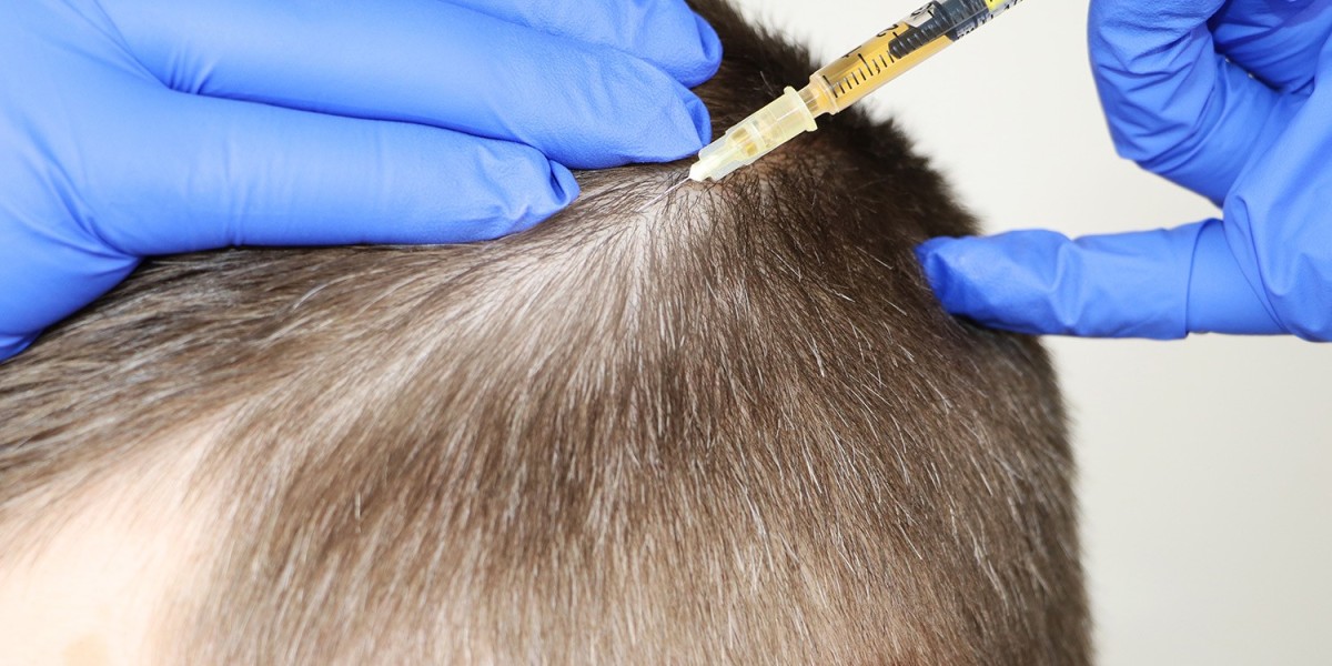 Can GFC Hair Transplant in Riyadh Help With Baldness?