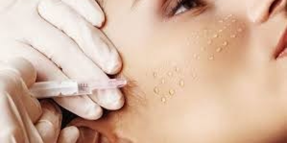 Mesotherapy in Dubai: Effective Cellulite Reduction