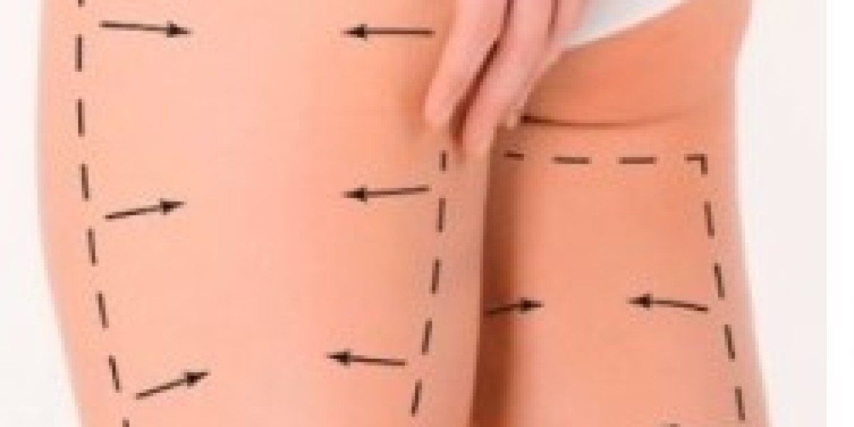Buttock Augmentation Aftercare: How to Preserve Your New Curves