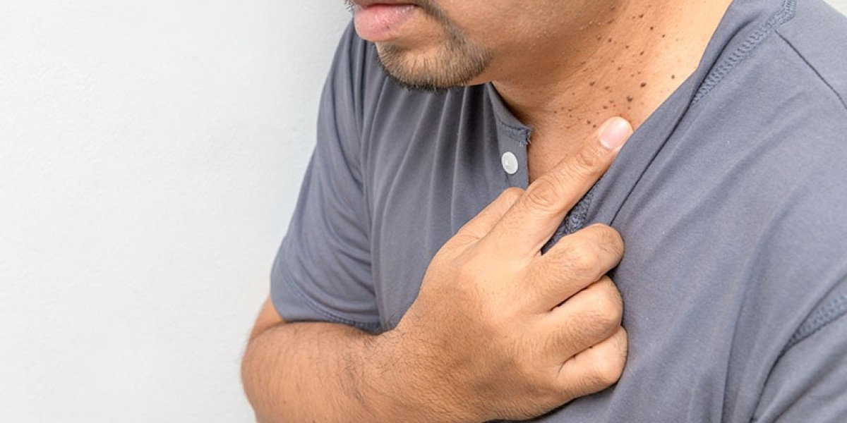 Skin Tag Removal: A Comprehensive Guide for First-Timers