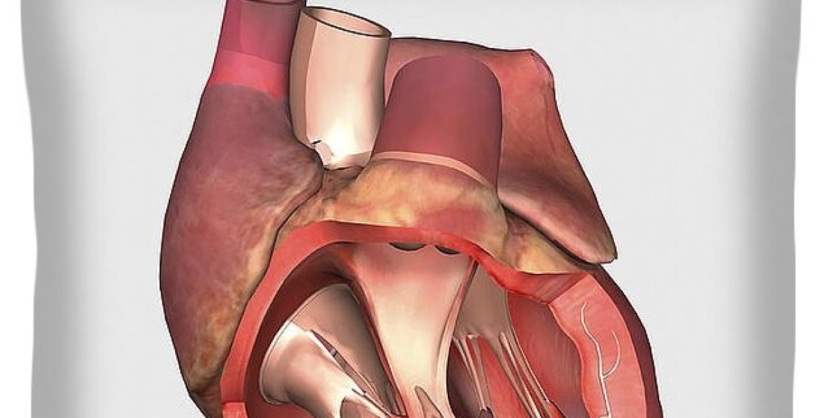 Heart Valve Devices Market Strategies Leveraging Emerging Technologies for Better Outcomes