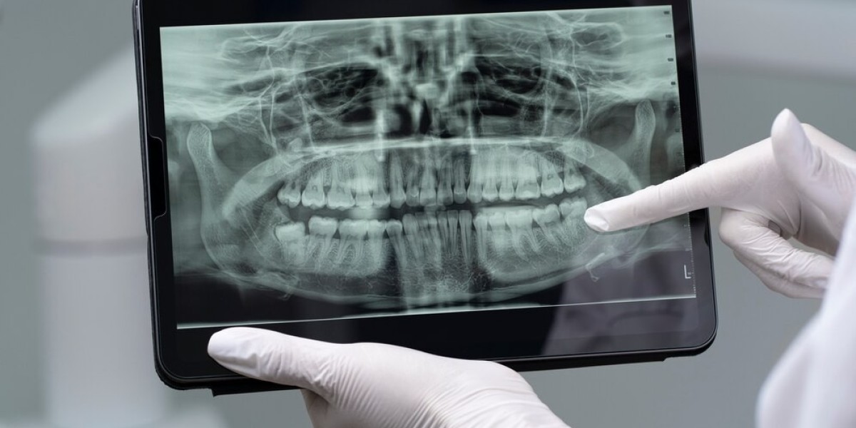 Dental Radiography Market Trends, Innovations, and Forecast 2030