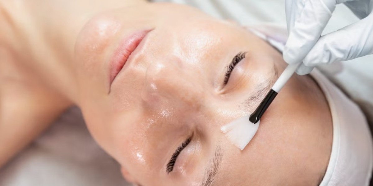 Top 5 Chemical Peel Clinics in Riyadh for Clearer Skin