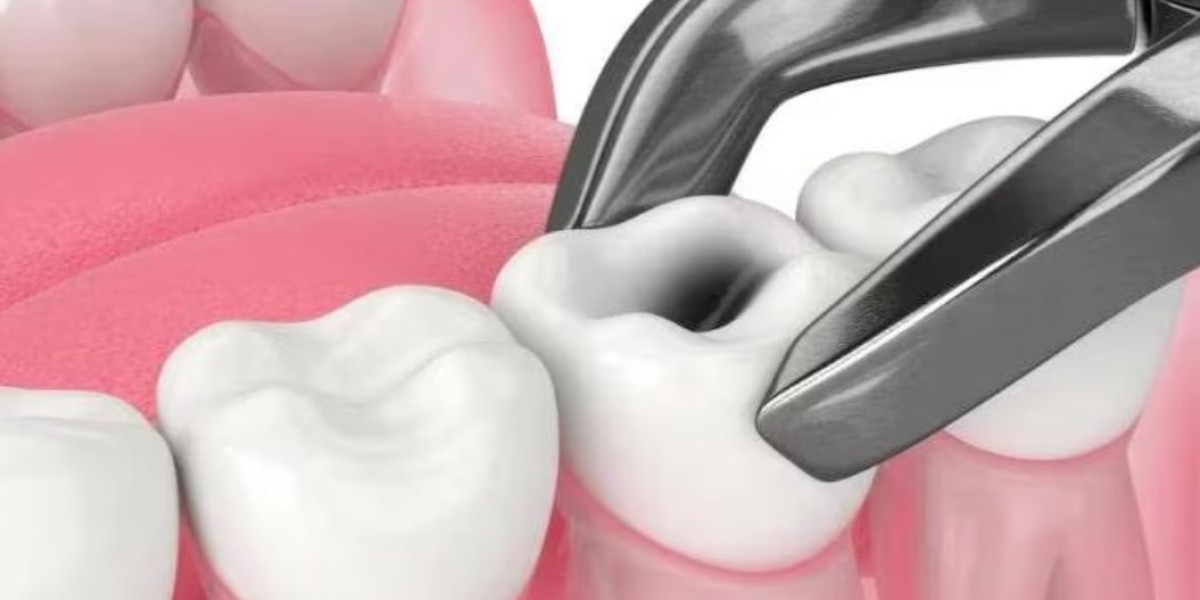 Is Tooth Extraction Safe? What You Should Know