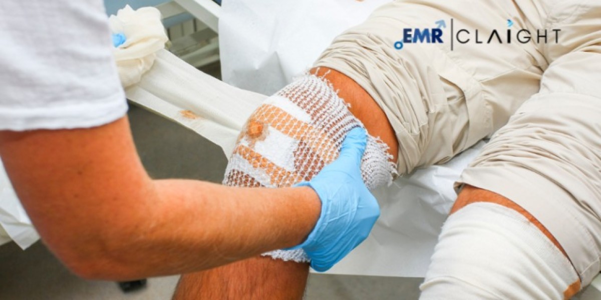 Global Wound Care Market Analysis: Key Companies, Growth Trends & Future Forecast, 2025-2034