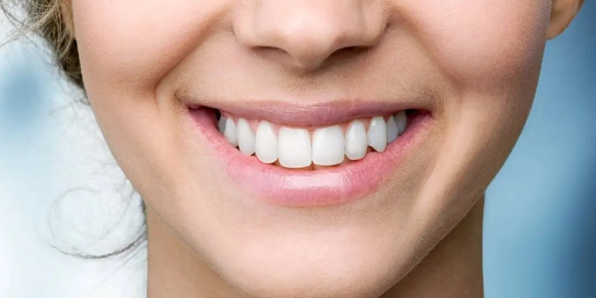 Fastest Teeth Whitening in Dubai – See Instant Results!