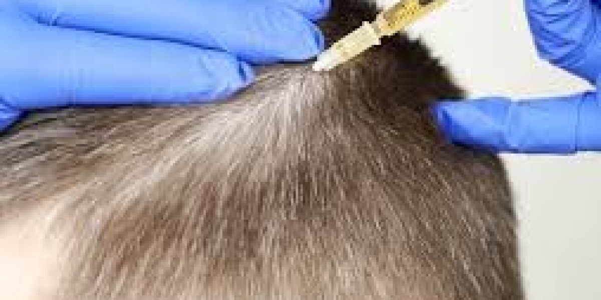 Stop Hair Loss in Its Tracks with PRP Treatment in Riyadh