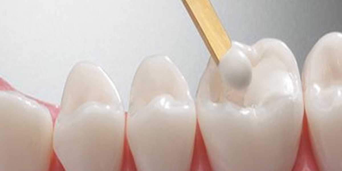 Tooth Filling Materials Market Innovations Transforming Dental Restorations With Advanced Technologies
