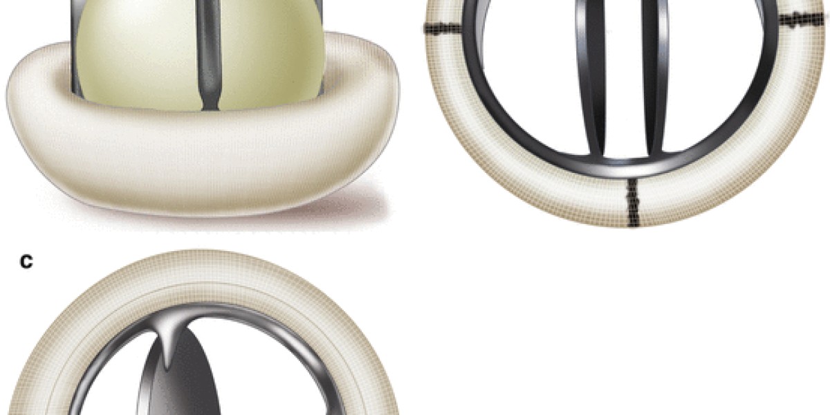Prosthetic Heart Valves Market: Understanding the Influence of Regional Healthcare Systems