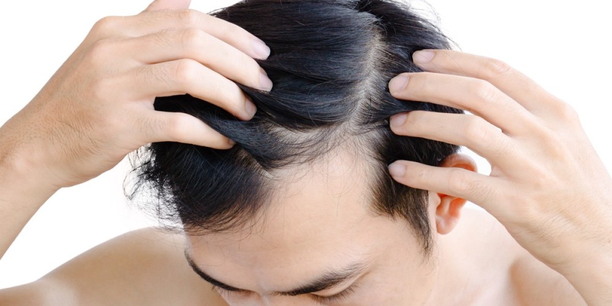 Is Finasteride for Hair Loss a Preventative or Restorative Treatment?