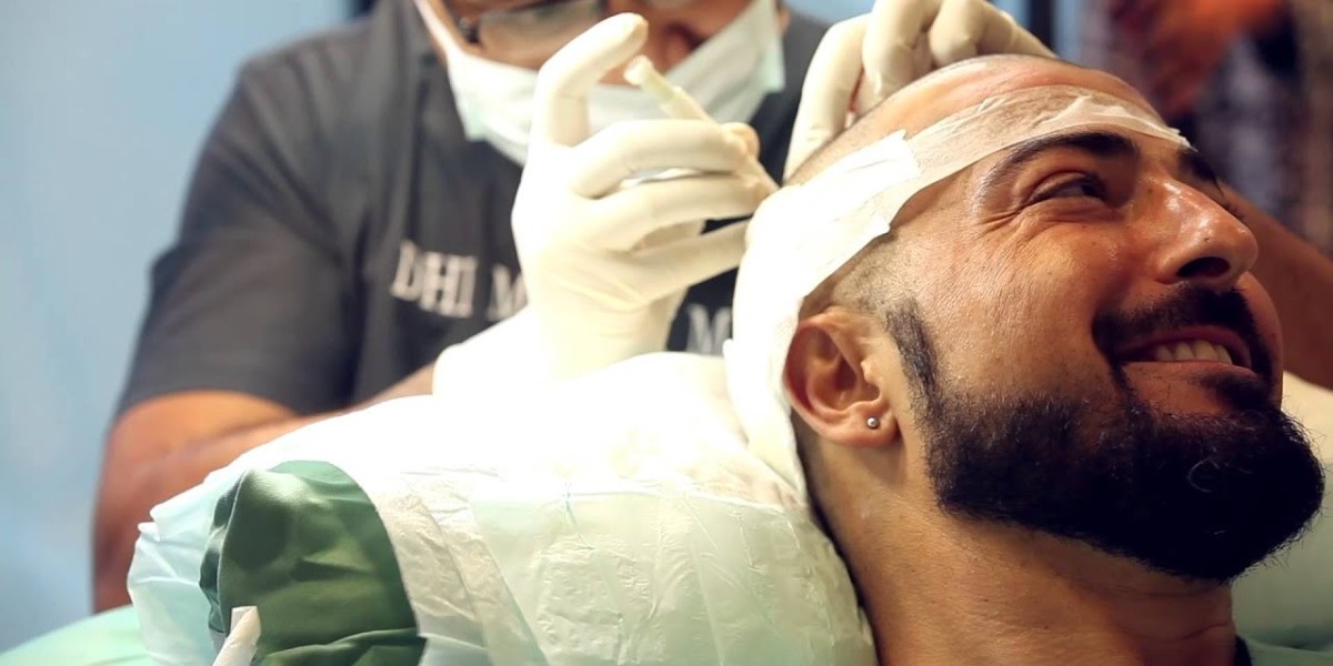 What Are The Different Types Of Hair Transplant Techniques?